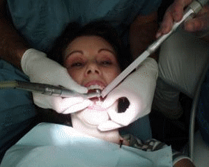 Dentistii: Medicina dentara este inlaturata din sistemul public al asigurarilor de sanatate