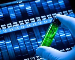 GlaxoSmithKline va face o oferta ostila de preluare a Human Genome Sciences