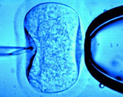 Fertilizarea in vitro, gratuita si in Romania! Vezi aici in ce conditii