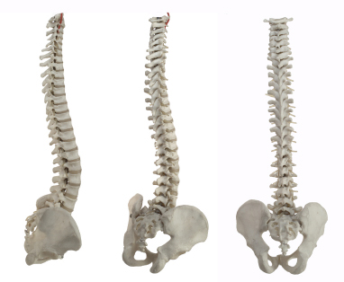 Osteoporoza poate evolua tacut. Atentie la simptomele ei!