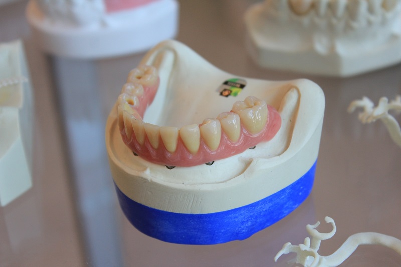 Ce consecinte are pierderea dintilor asupra organismului?