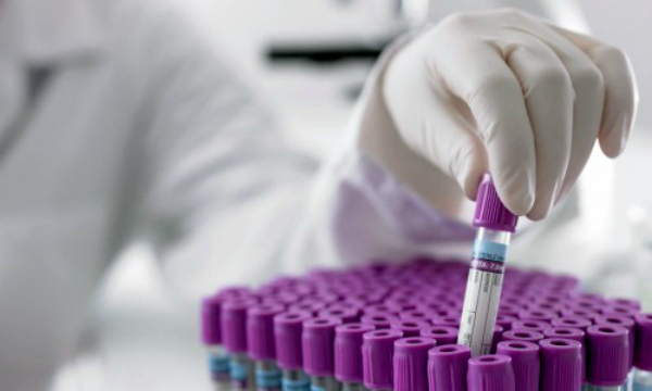 Biochimistii alerteaza populatia: analizele de laborator - efectuate de absolventi fara pregatire speciala