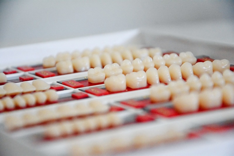 Cine sunt pacientii eligibili pentru tratamentul stomatologic cu fatete dentare? Exista contraindicatii cu privire la acestea?