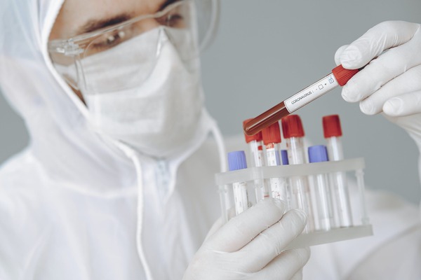 Vesti bune: pretul mediu al unui test RT-PCR a scazut la 322 de lei, de la 520 de lei, in 2020