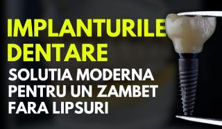 Implanturile Dentare: Solutia Moderna pentru un Zambet Fara Lipsuri