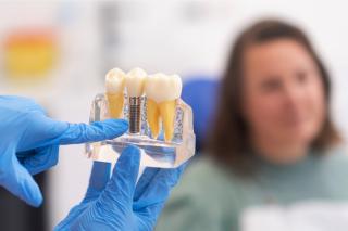 Implant dentar: solutia permanenta pentru dintii pierduti