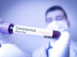 Medic: Iritatia pielii poate fi un simptom pentru infectarea cu noul coronavirus