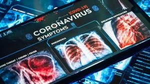 Specialist: Chiar daca scapam acum de coronavirus, el va reveni la toamna
